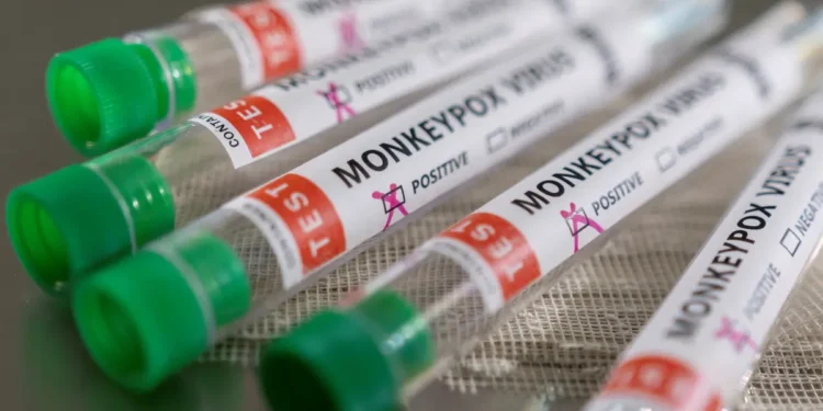 Denmark, Scotland detect first monkeypox virus cases