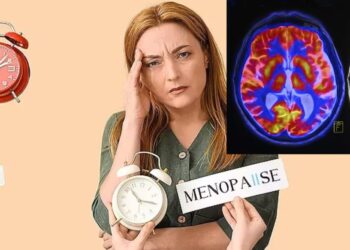 Menopause causes changes in the brain – UK research shows